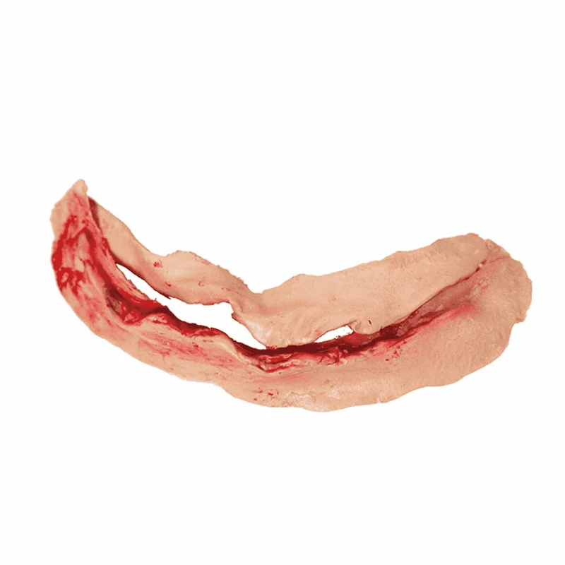 Herida Cuello